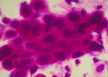 China Creates AI to Read Cancer Images