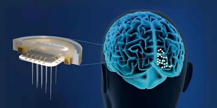 China Approves First Commercial Brain Implant